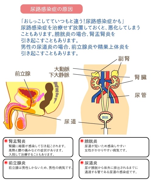 心理的な勃起不全治療